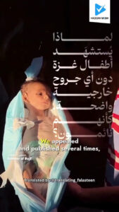 لماذا يستشهد أطفال غزة دون أى جروح خارجية واضحة، كأنهم نائمون؟