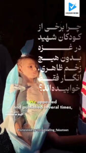 چرا برخی از کودکان شهید در غزه بدون هیچ زخم ظاهری، انگار فقط خوابیده‌اند؟
